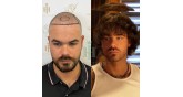 Hair of Istanbul-πριν και μετά